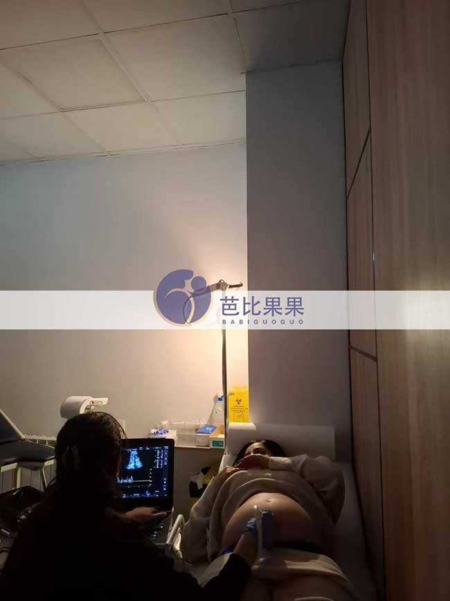 格鲁吉亚试管妈妈做B超