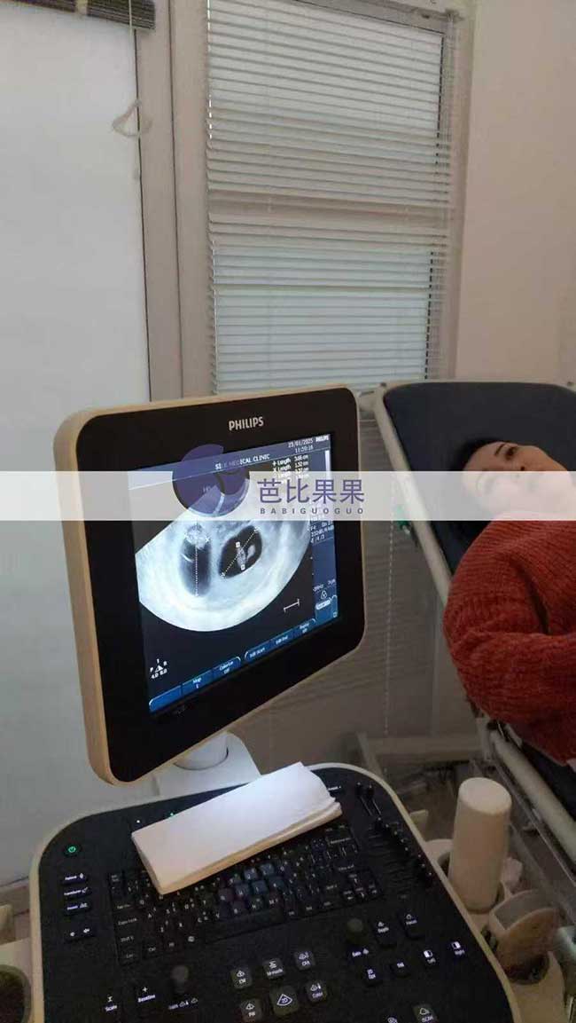 双胞胎试管妈妈B超检查