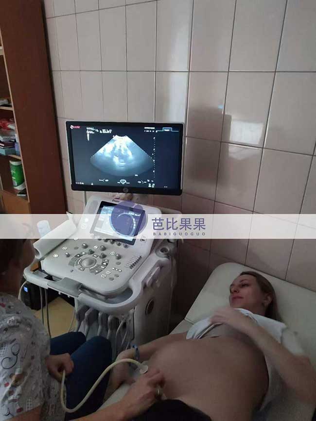 试管妈妈做B超