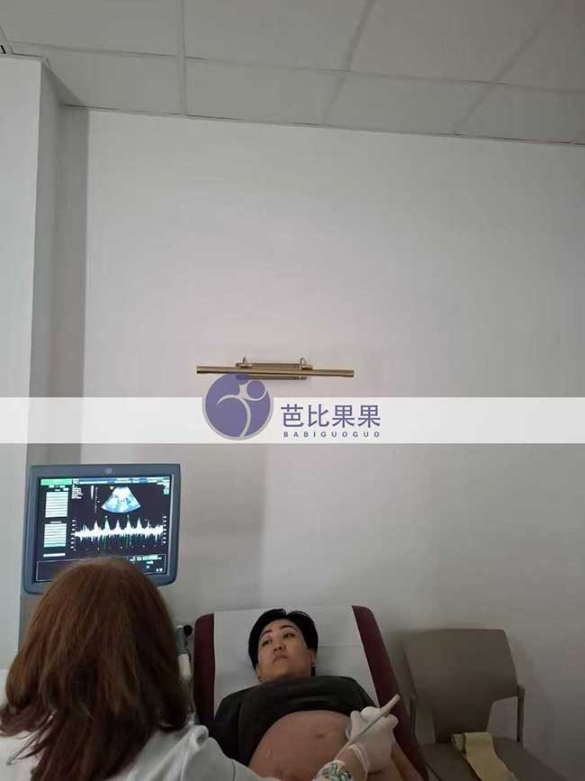温先生到格鲁吉亚匹配的试管妈妈完成孕24周的四维彩超检查