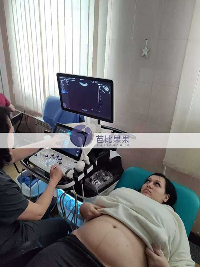 试管妈妈做四维彩超