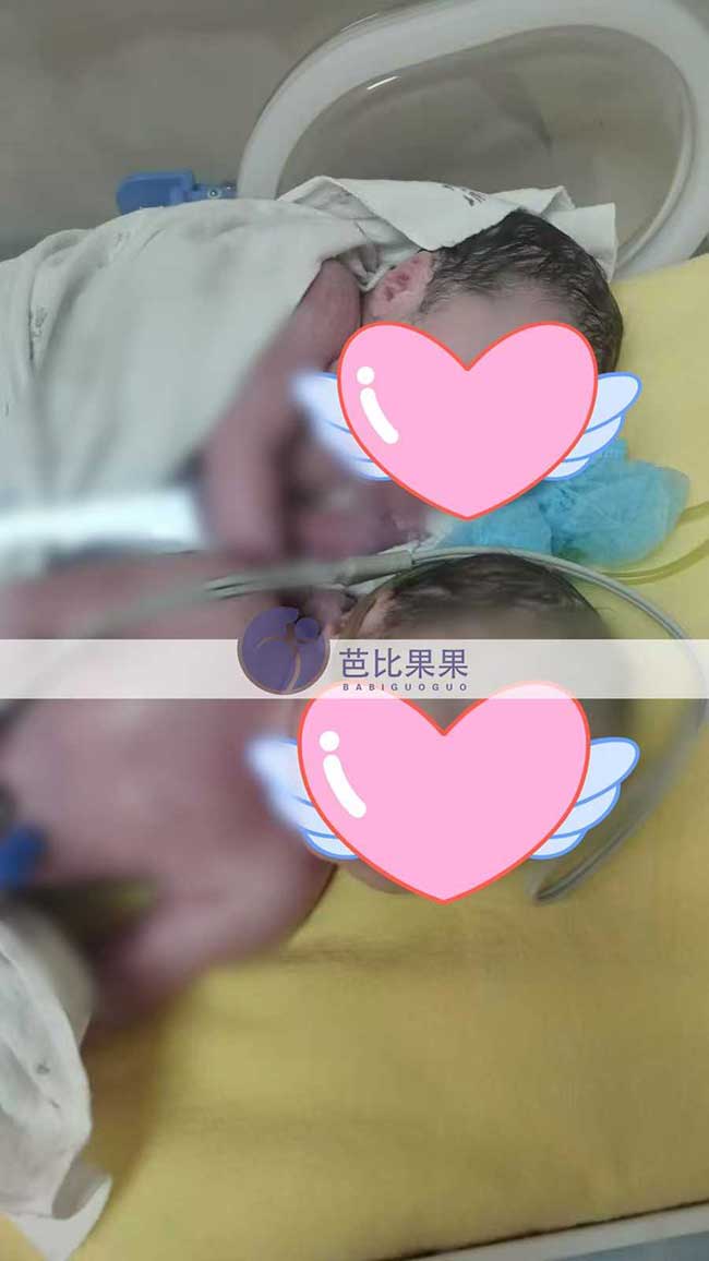 格鲁吉亚试管宝宝出生