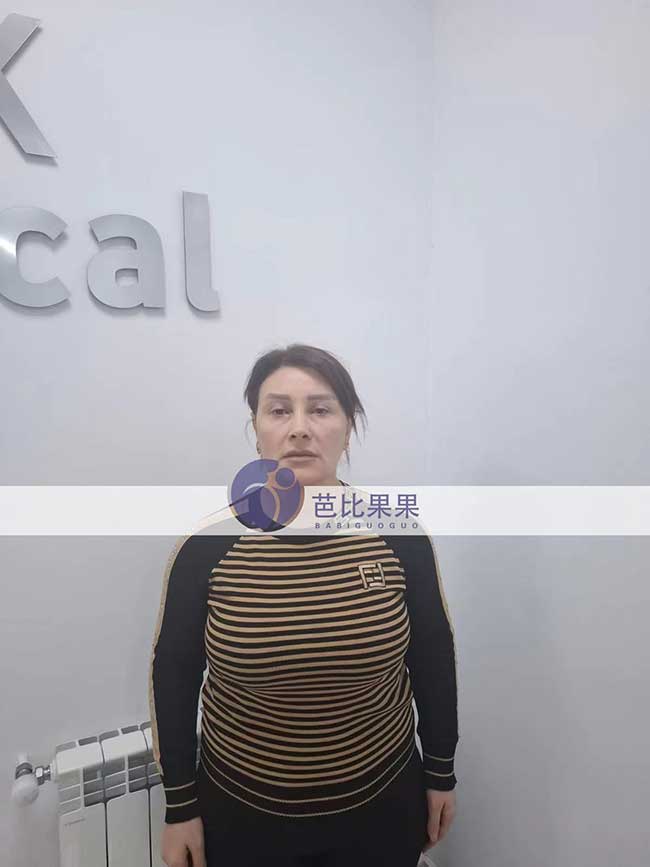 贺先生到格鲁吉亚试管匹配的妈妈来医院做孕12周的B超
