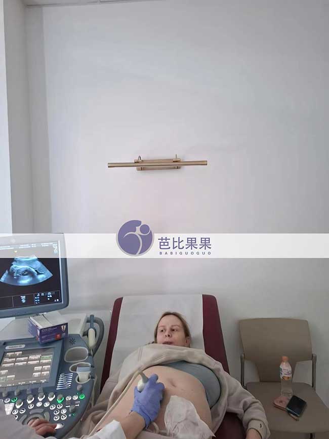 试管妈妈做B超