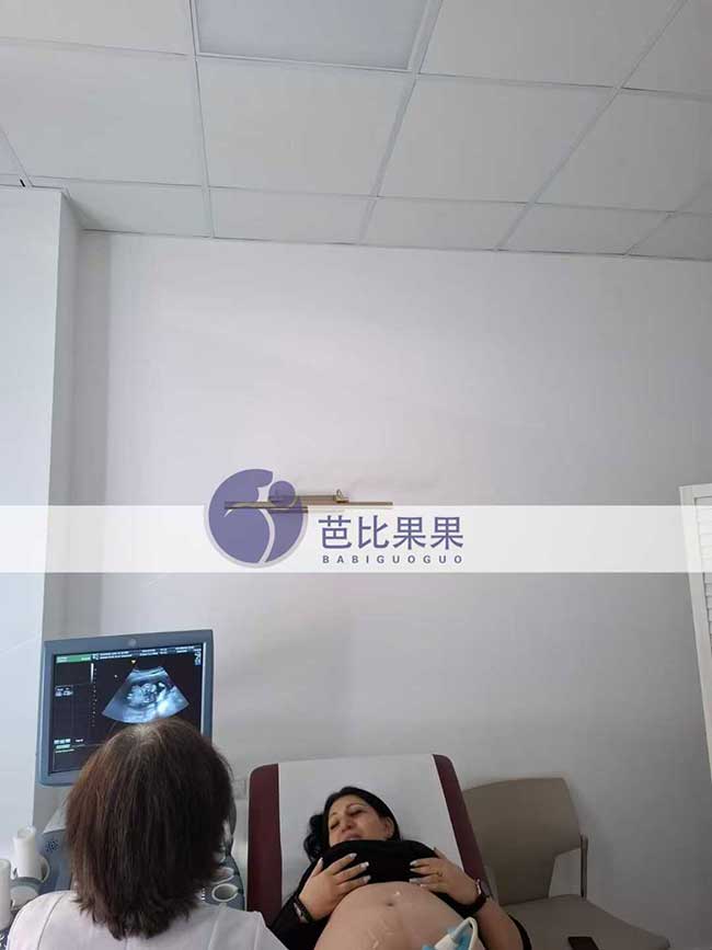 谢女士夫妇到格鲁吉亚自卵试管匹配的妈妈来医院做四维彩超