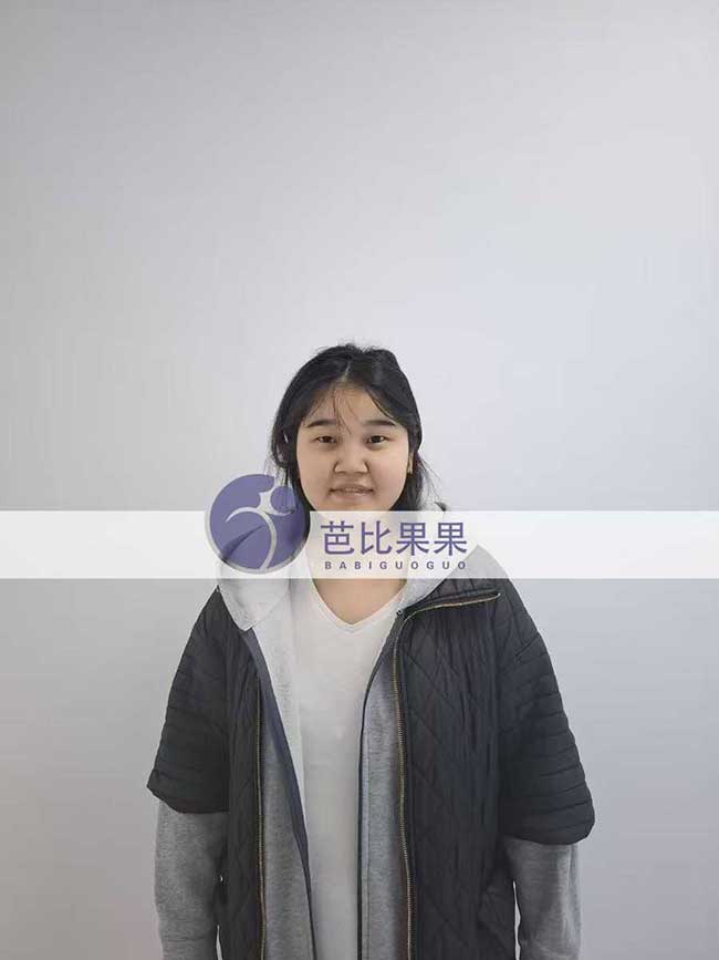 试管妈妈做四维彩超
