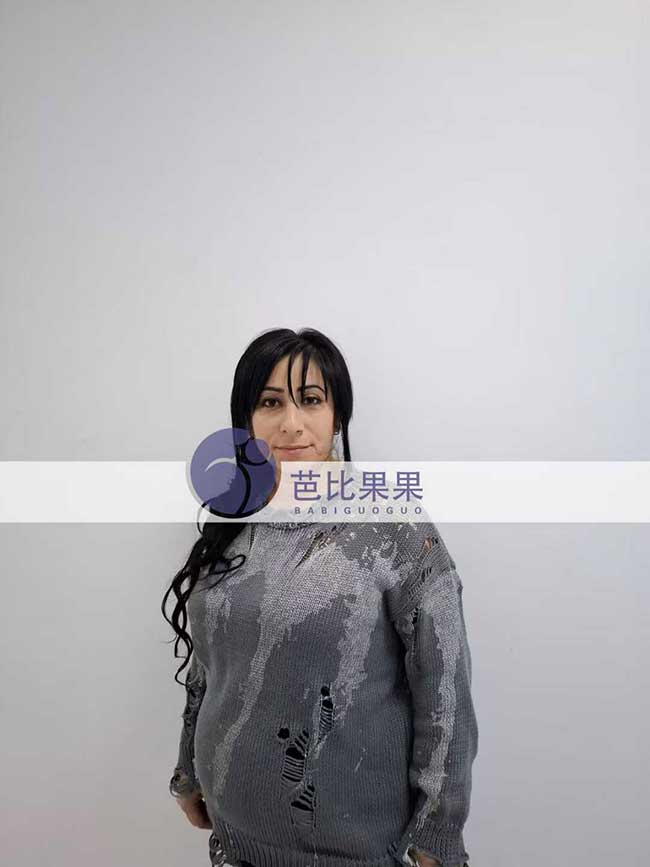 试管妈妈做四维彩超