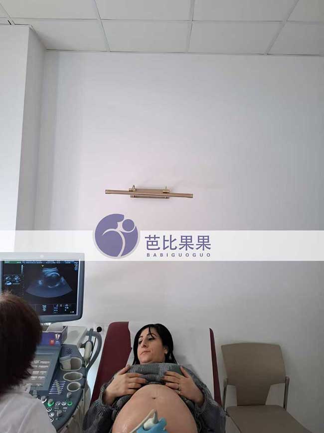 试管妈妈做四维彩超