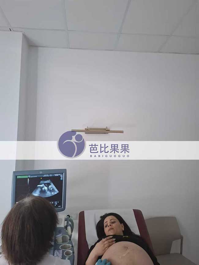 试管妈妈做四维彩超