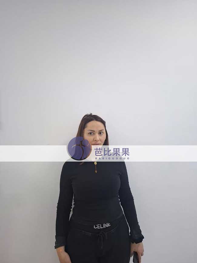 浙江闫先生在格鲁吉亚匹配的试管妈妈来医院做B超