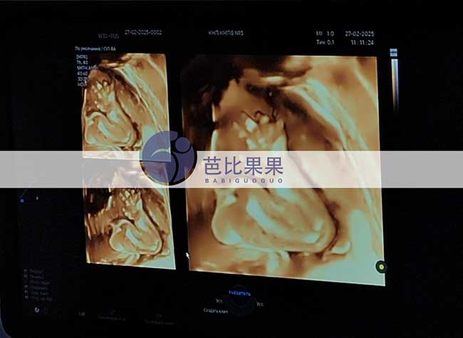 试管妈妈做B超