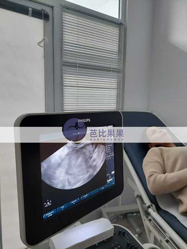 试管妈妈做B超