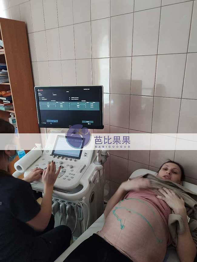 试管妈妈做B超
