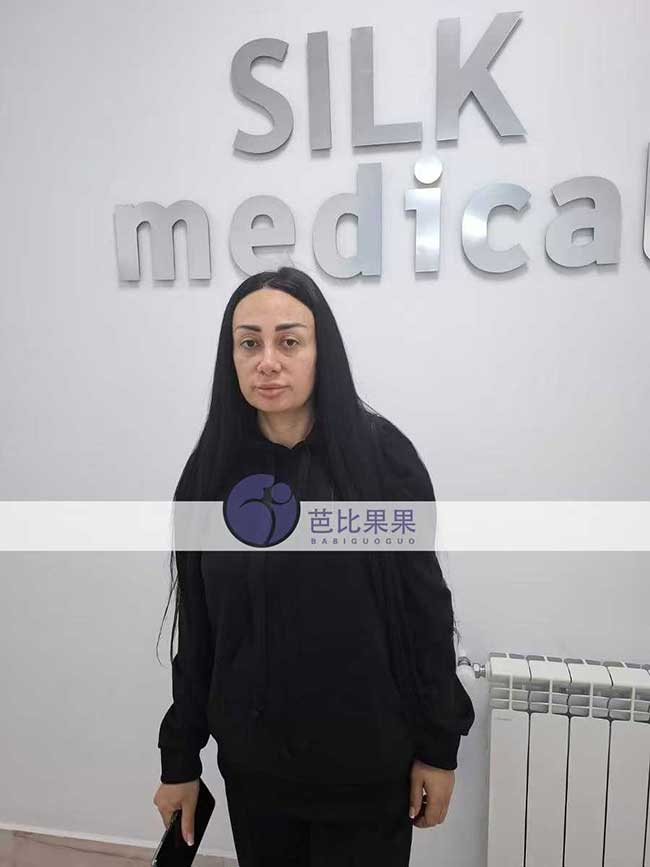江苏万先生到格鲁吉亚匹配的试管妈妈来医院做B超