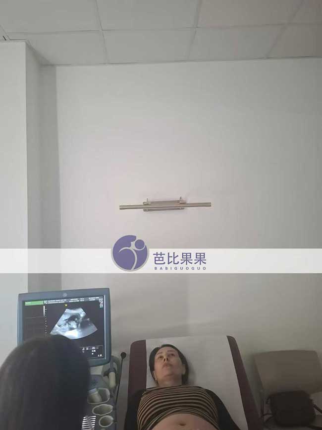 试管妈妈做B超
