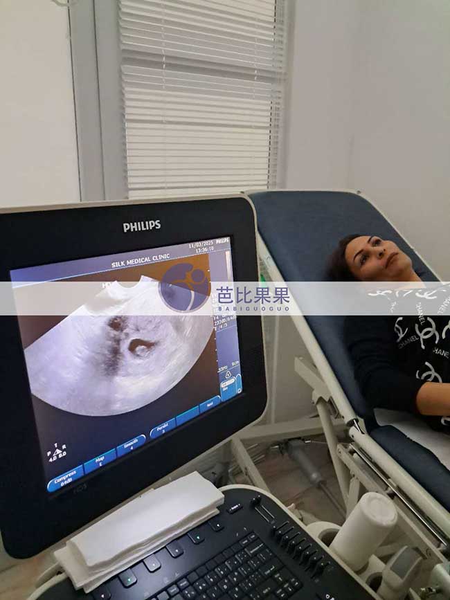 试管妈妈做B超