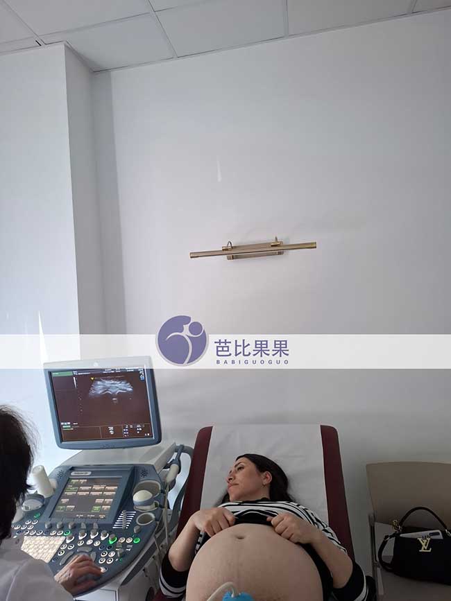 试管妈妈做B超