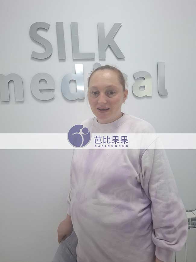 试管妈妈做B超