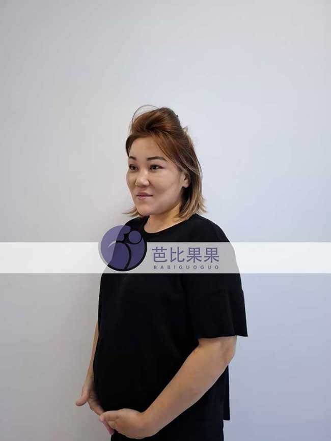 宁先生到格鲁吉亚匹配的试管妈妈来医院做B超