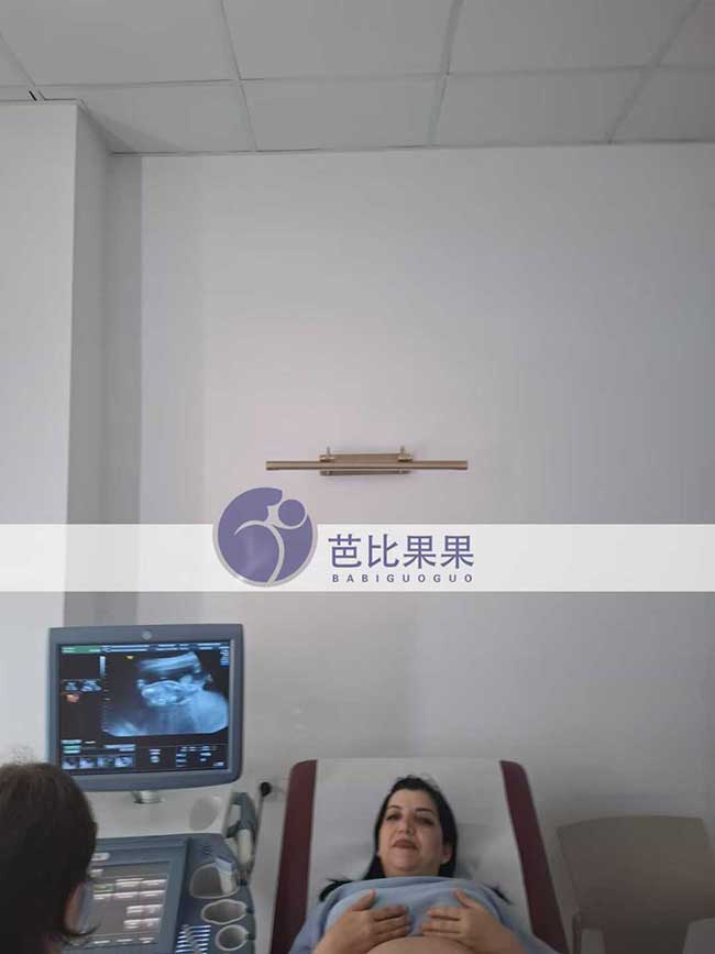 试管妈妈做孕19周B超