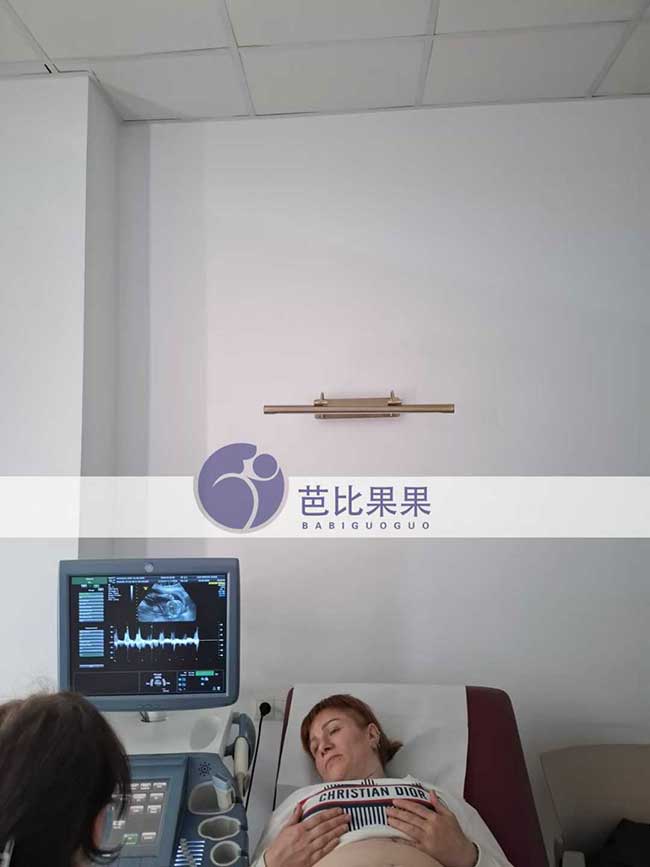 试管妈妈做孕19周B超