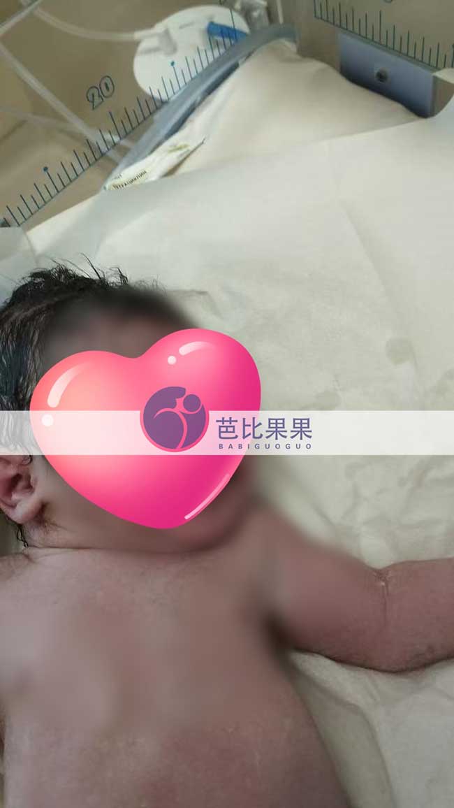 汪先生到格鲁吉亚匹配的试管妈妈孕39周顺产男宝宝