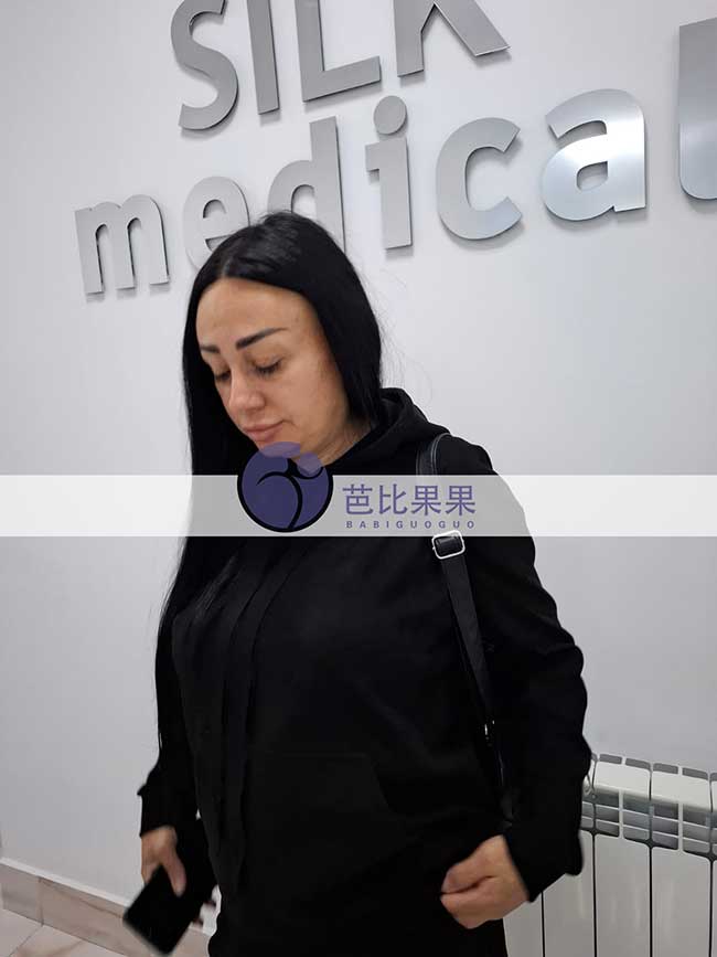 试管妈妈做B超