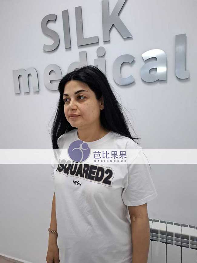 黄先生的试管妈妈按约定时间来silk医院做孕24周+B超检查