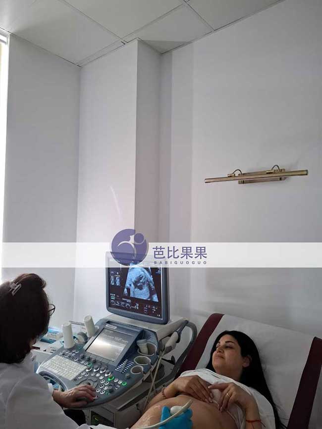 格鲁吉亚试管妈妈做B超