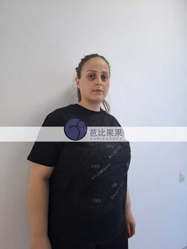 姚先生夫妇到格鲁吉亚匹配试管妈妈来医院做孕10周B超