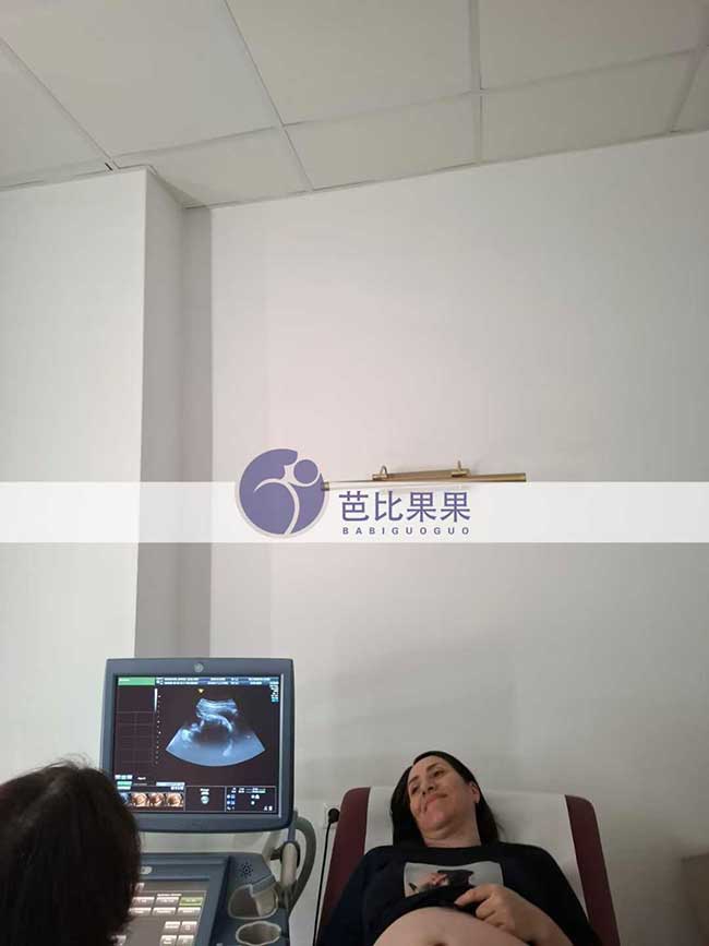 试管妈妈做四维彩超