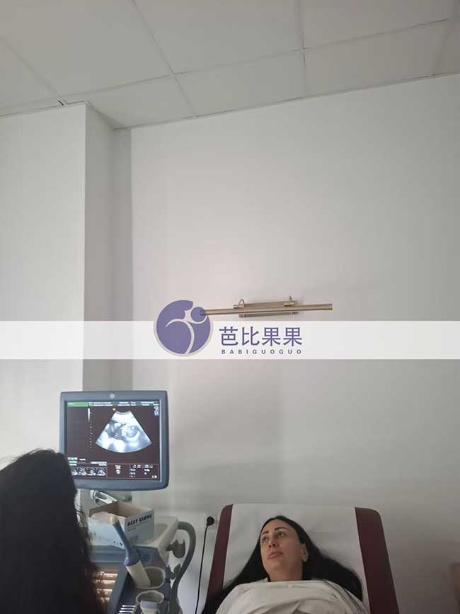 试管妈妈做B超