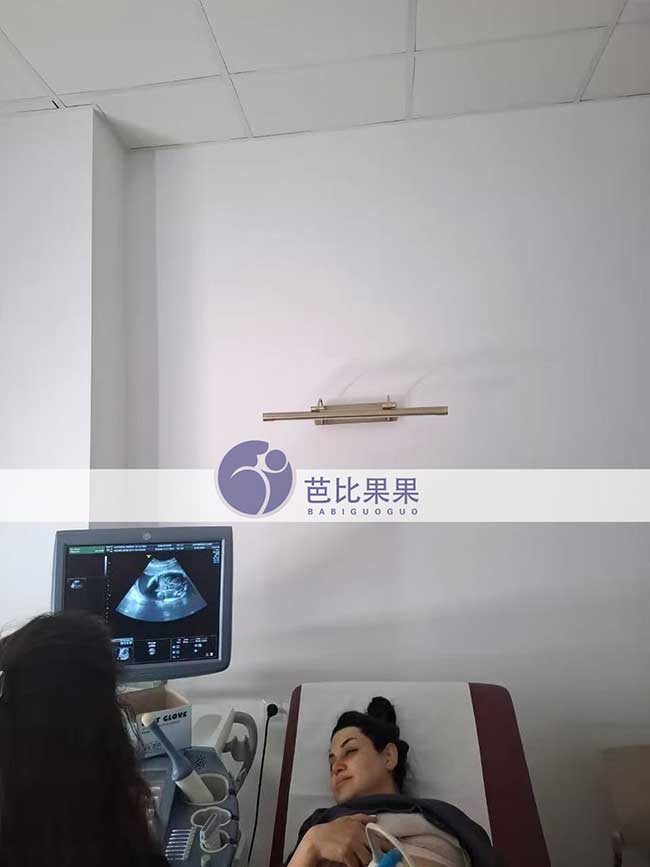 试管妈妈做四维彩超