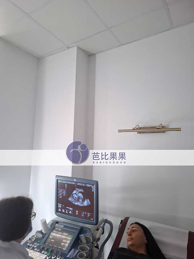 试管妈妈做B超