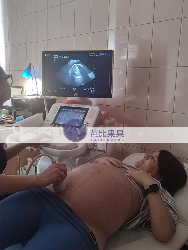 试管妈妈做B超
