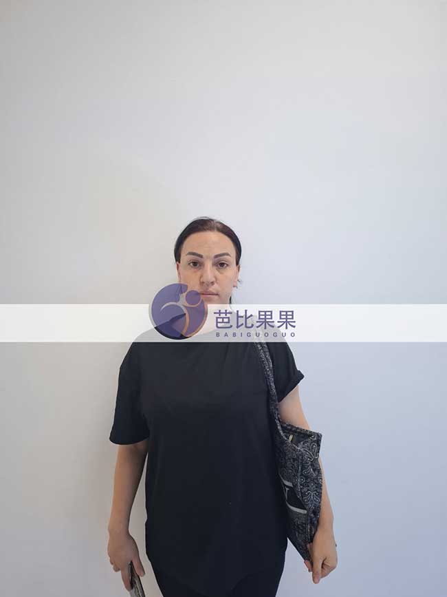 试管妈妈做B超