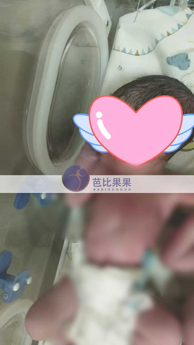 白先生选择到格鲁吉亚‌试管，双胞胎宝贝顺产出生