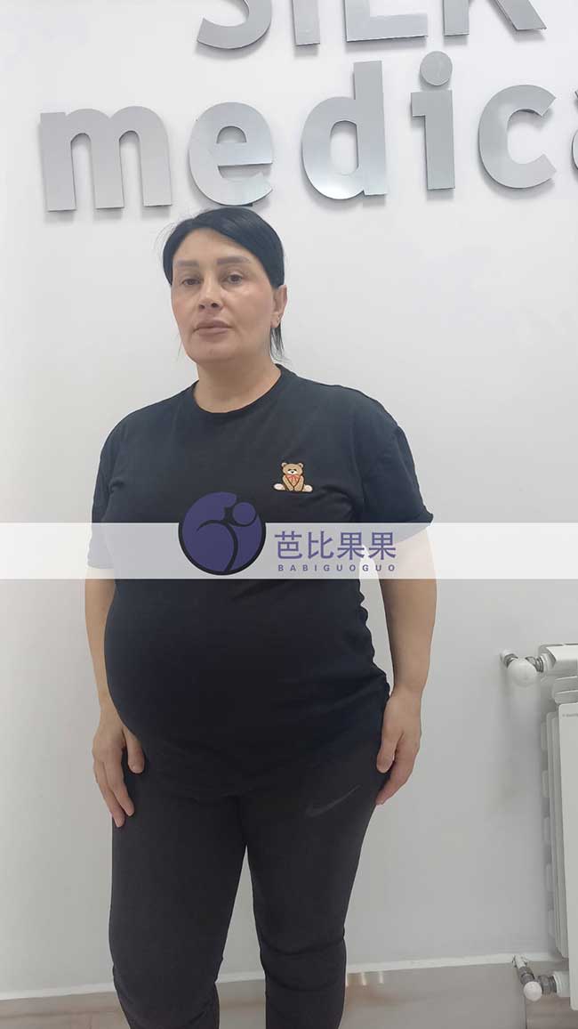 试管妈妈做B超