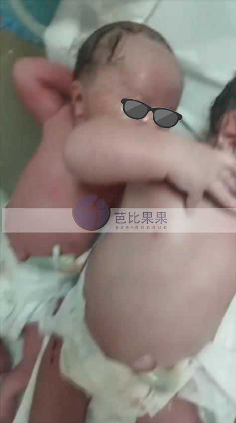 格鲁吉亚试管宝宝出生