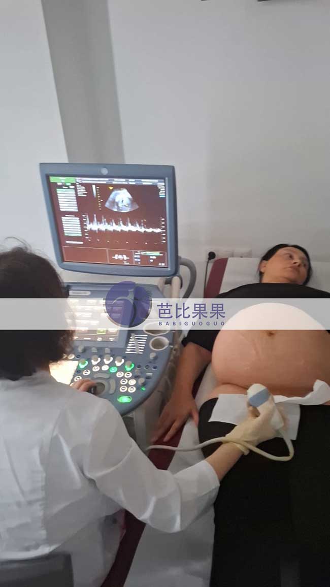 试管妈妈做B超