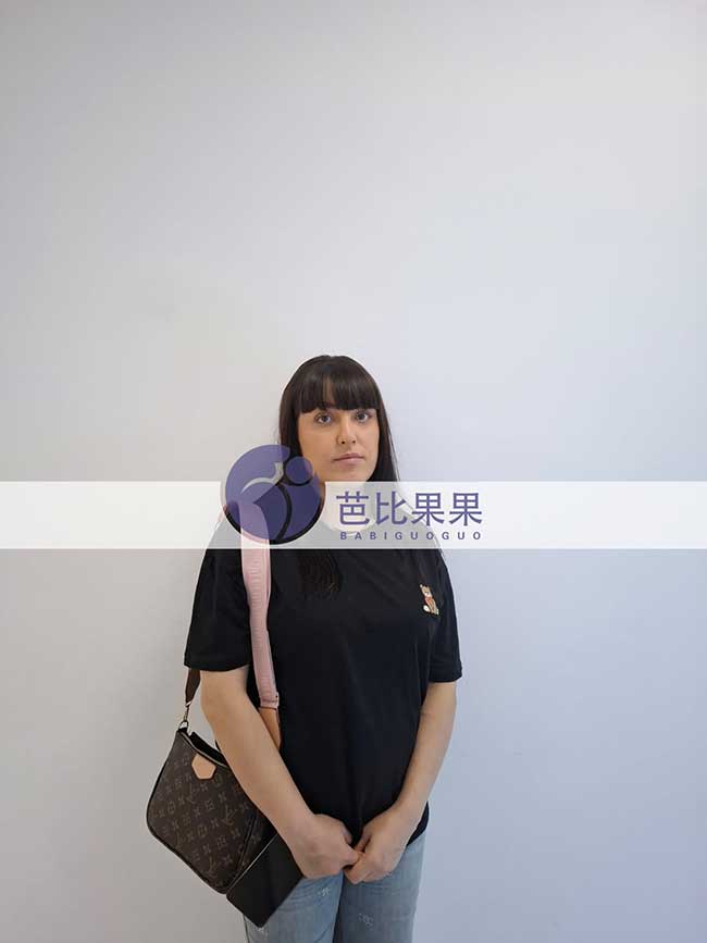 易先生在格鲁吉亚匹配的试管妈妈按时来医院做孕24周的四维彩超