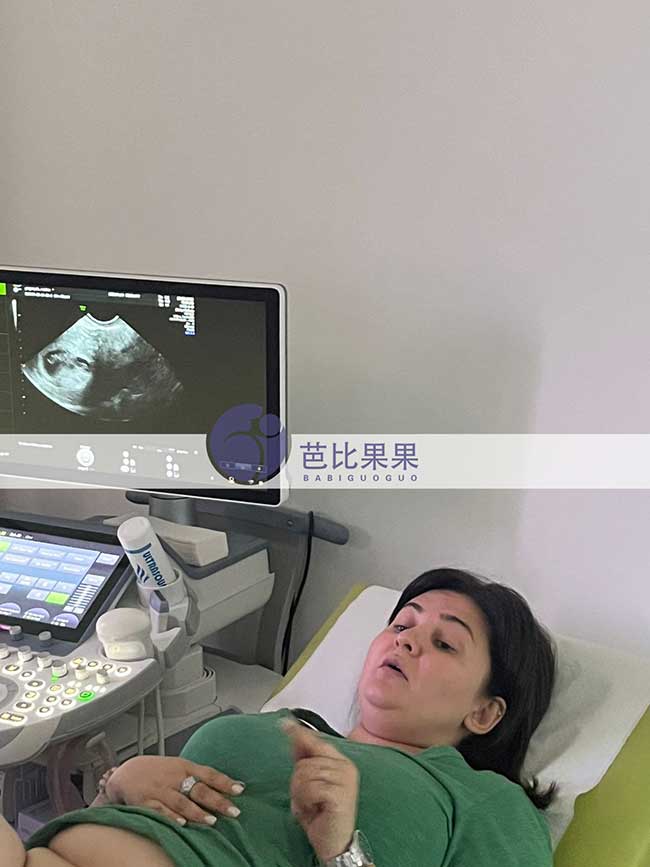 试管妈妈做B超