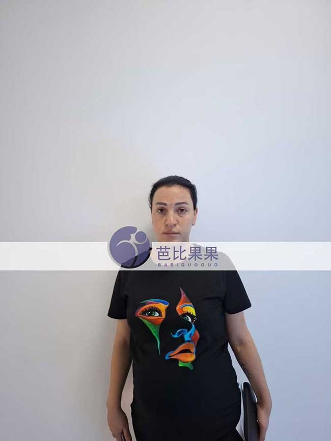 试管妈妈做B超