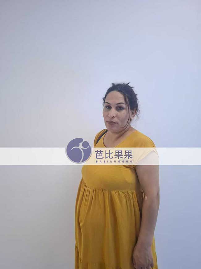 试管妈妈做B超