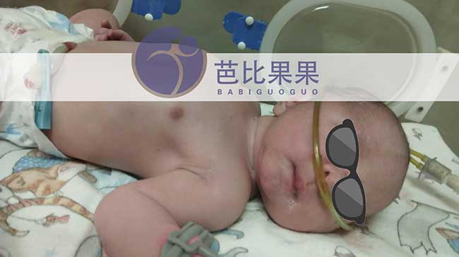 试管宝宝出生