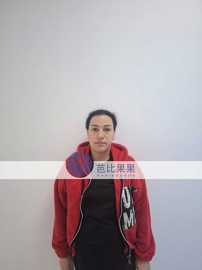 郭先生到格鲁吉亚匹配的试管妈妈来医院做孕32周B超