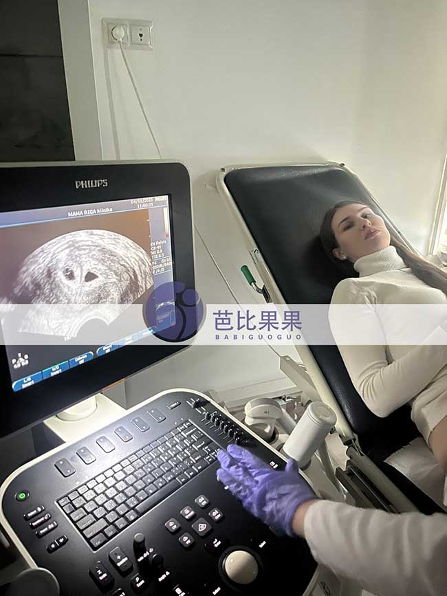 试管妈妈首次B超