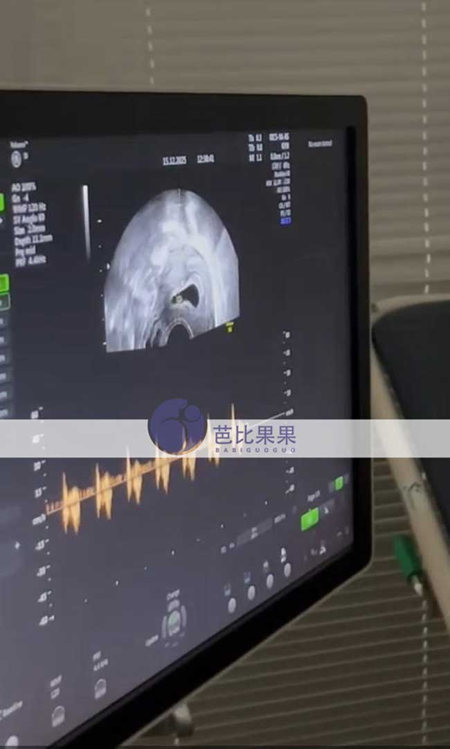 试管妈妈验孕成功