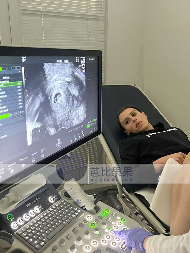 试管妈妈首次B超