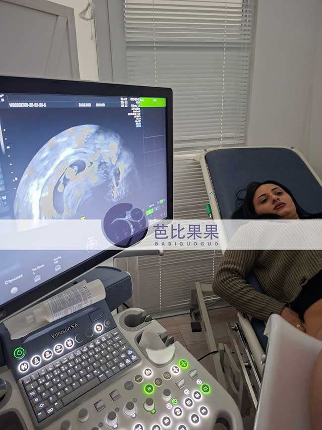 段先生到格鲁吉亚匹配的试管妈妈完成孕9周产检